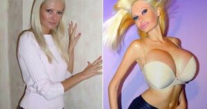 30+ Shocking Transformations: People Who Took Plastic Surgery to the Next Level
