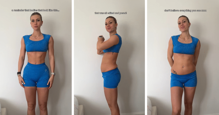“This Is Me”: 30 Powerful Photos of Women Embracing Their Real, Unfiltered Bodies